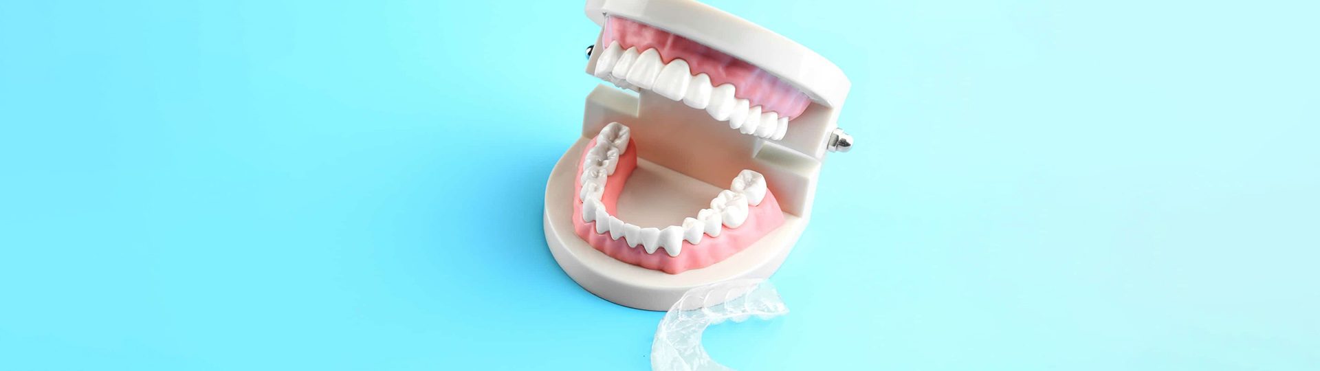 6 Benefits of Replacing a Missing Tooth With a Tooth Bridge