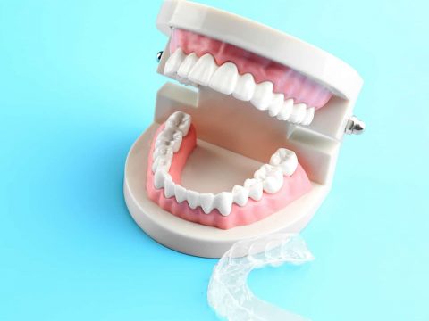 6 Benefits of Replacing a Missing Tooth With a Tooth Bridge