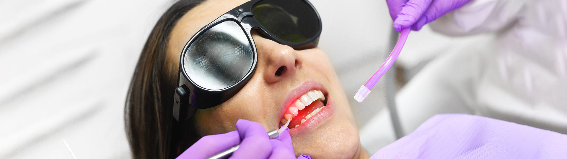 How to Fix a Chipped Front Tooth? Explore Your Repair Options