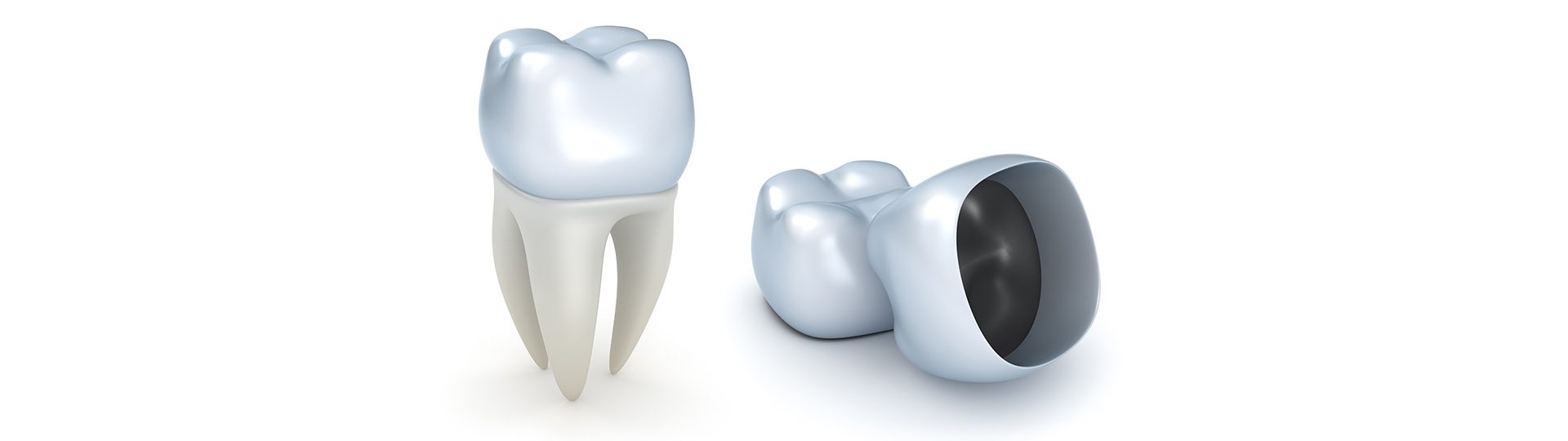Why a Broken Dental Crown Feels Sharp and What You Can Do About It