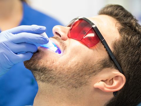 Common Teeth Whitening Myths You Should Stop Believing